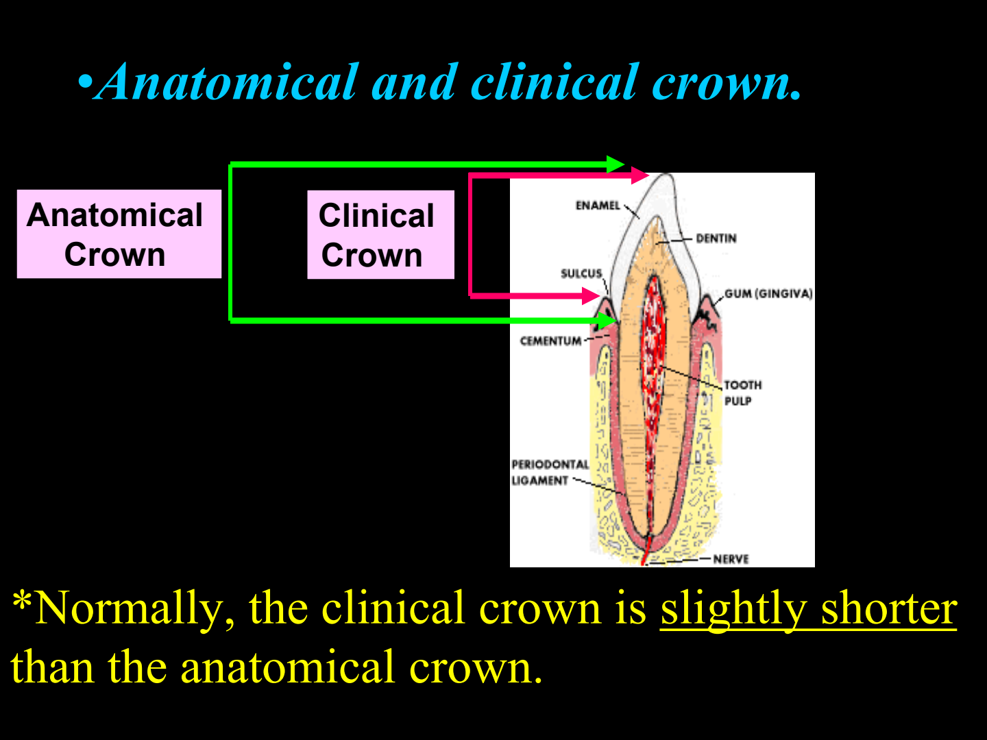 Normally clinical crown is shorter