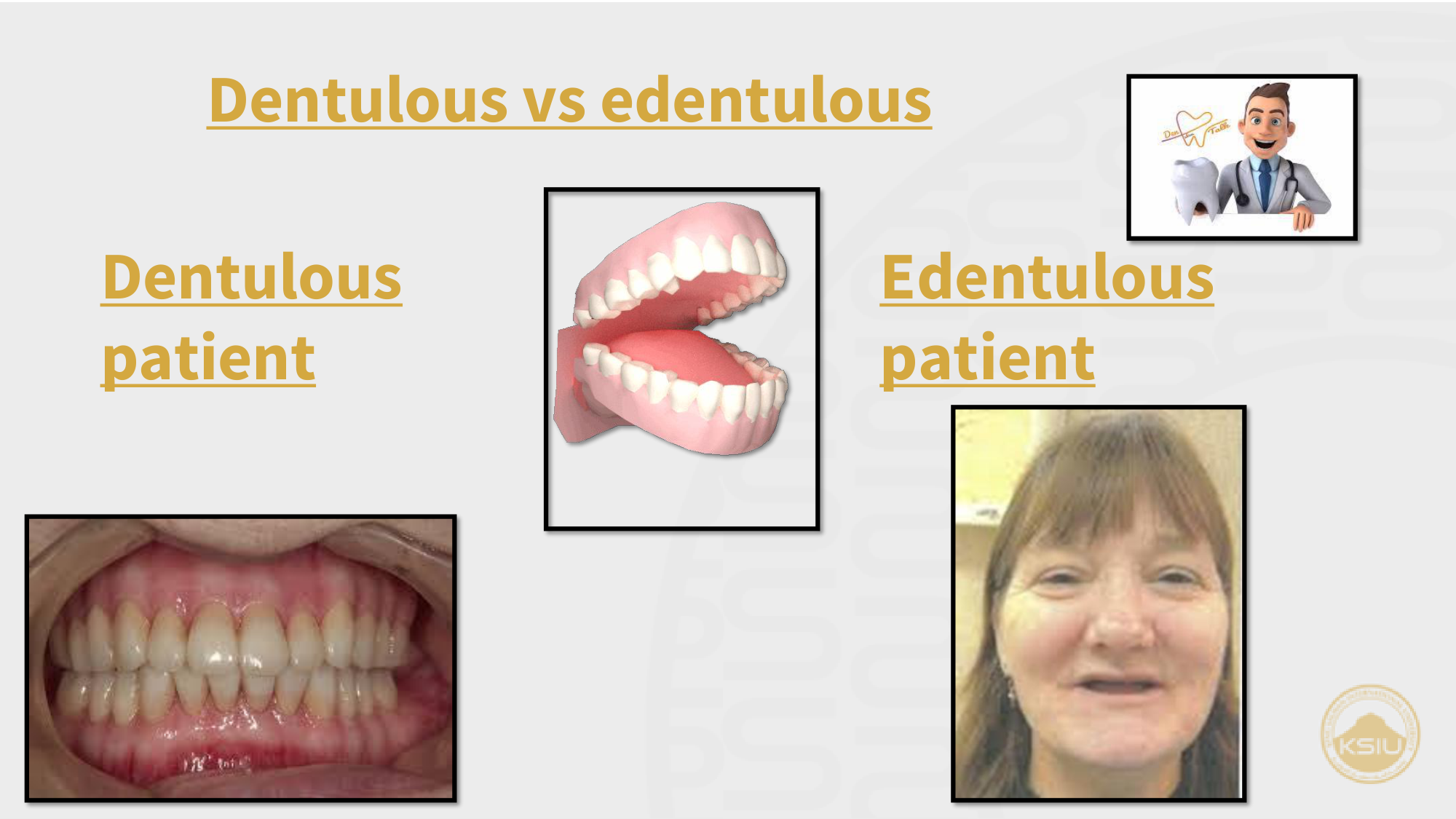 Dentulous vs Edentulous