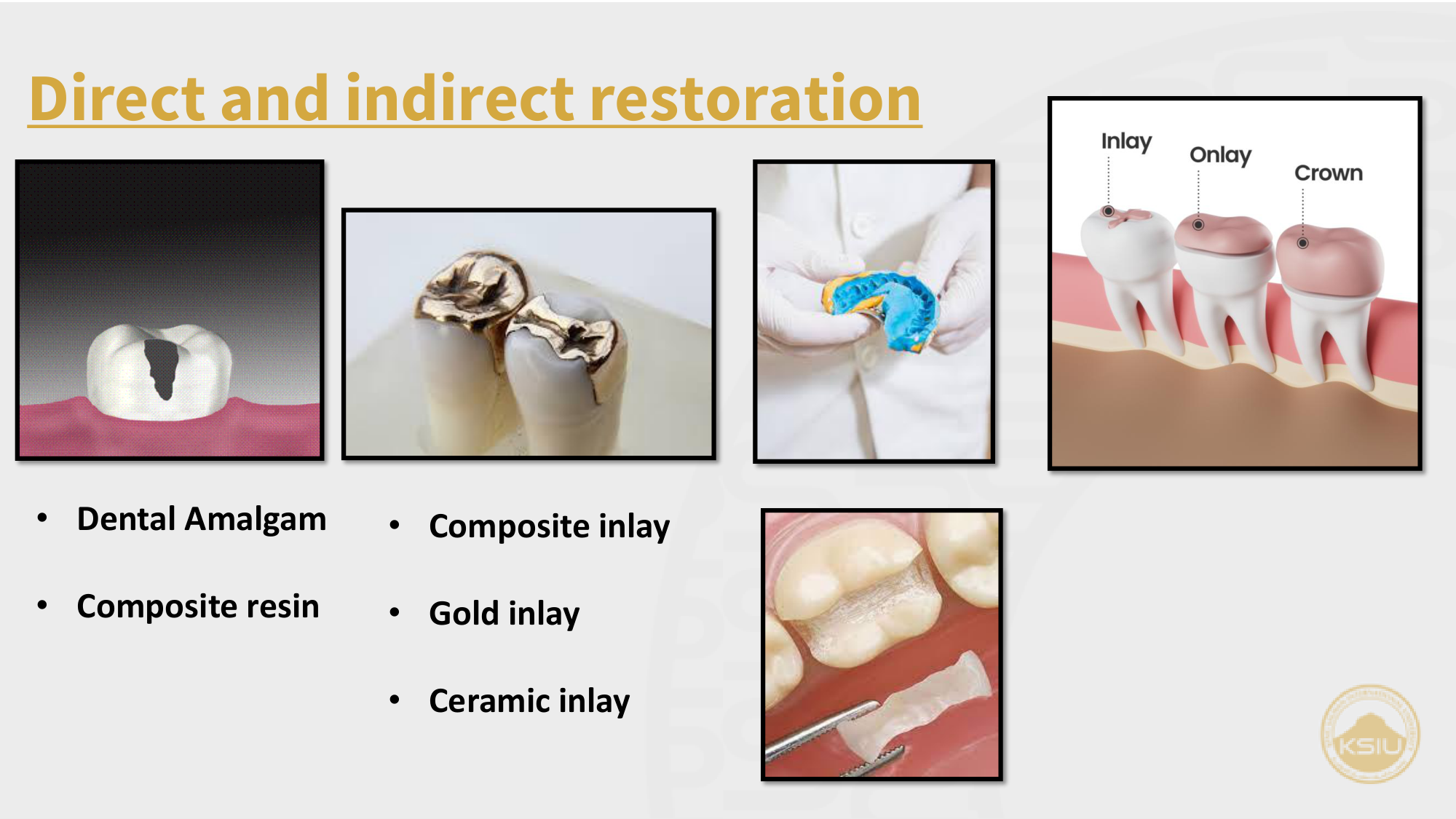 Direct and indirect restoration