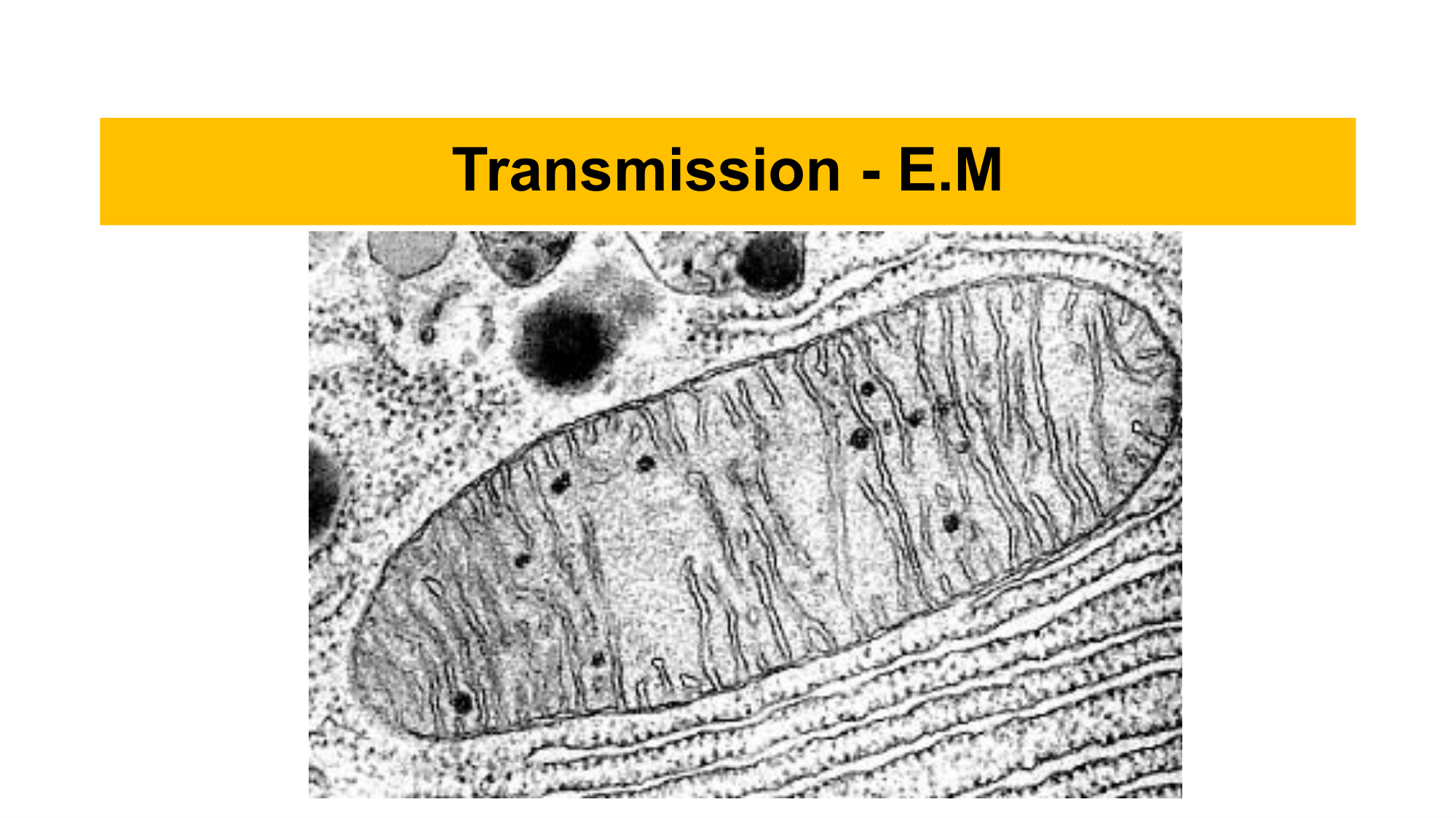Transmission E.M - Slide 8