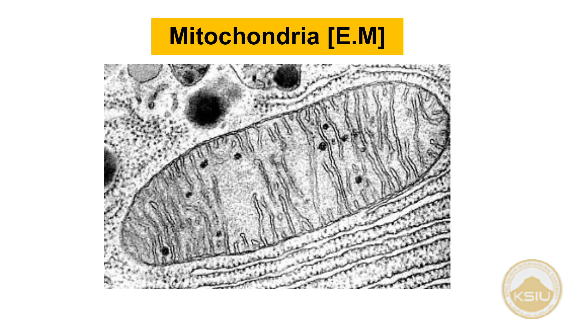 Mitochondria E.M picture - Slide 29