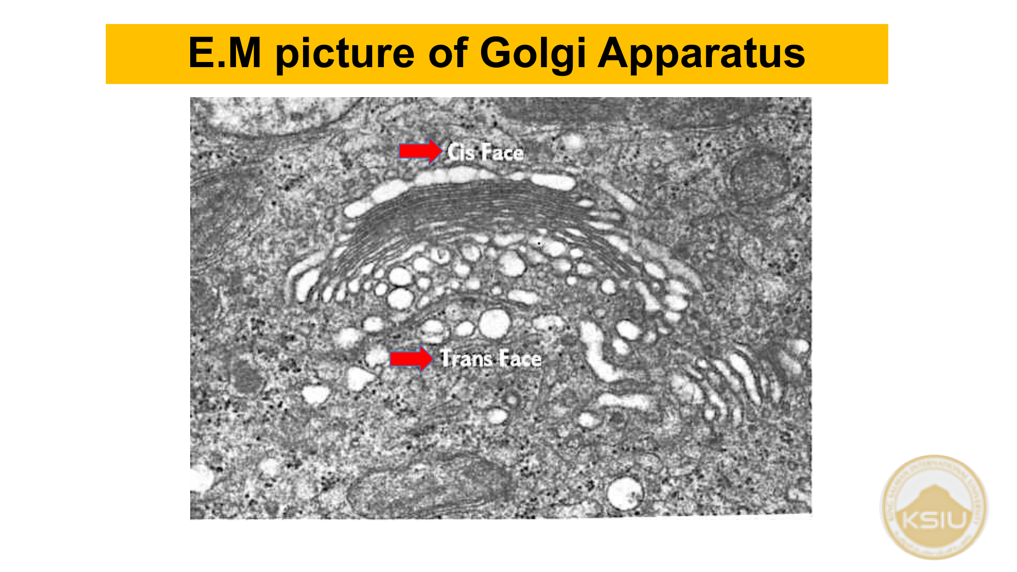 EM picture of Golgi Apparatus - Slide 41